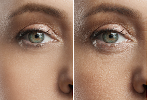 ALCS Technology by Stillersafe: Ultimate Eye & Skin Protection for Screen Warriors